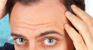 تعبیر خواب کچل شدن ابن سیرین و حضرت یوسف و قسمتی از سر زن و دختر مجرد