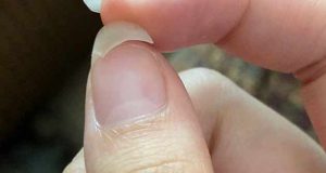 تعبیر خواب شکستن ناخن امام صادق و حضرت یوسف + کاشته شده برای دختر مجرد
