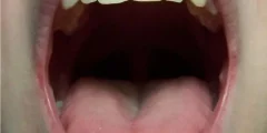 تعبیر خواب دهان ابن سیرین + کج شدن و کف از دهان آمدن برای زن و دختر مجرد تعبیر خواب دهان ابن سیرین + کج شدن و کف از دهان آمدن برای زن و دختر مجرد