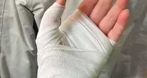 تعبیر خواب زخم امام صادق و ابن سیرین + زخمی شدن دست و پا و صورت دیگران