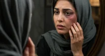 تعبیر خواب کبود شدن صورت + از امام صادق و ابن سیرین و سایر معبران